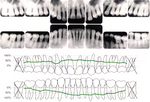 歯のレントゲン.jpg